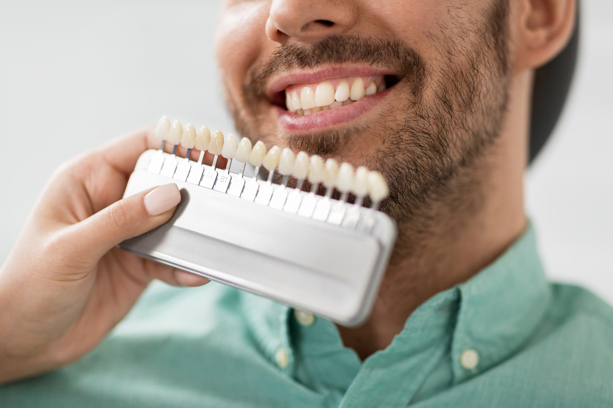 Are you thinking about getting dental veneers? Here's everything you need to know about dental veneers, including the core benefits.