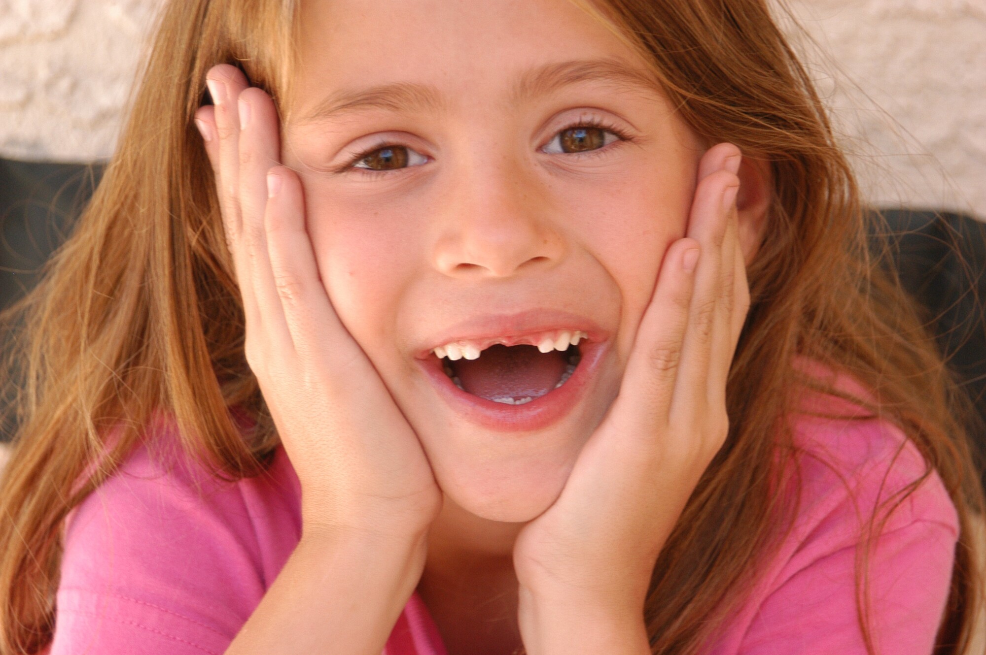 4 Possible Solutions For Missing Teeth Wake Up Roma 