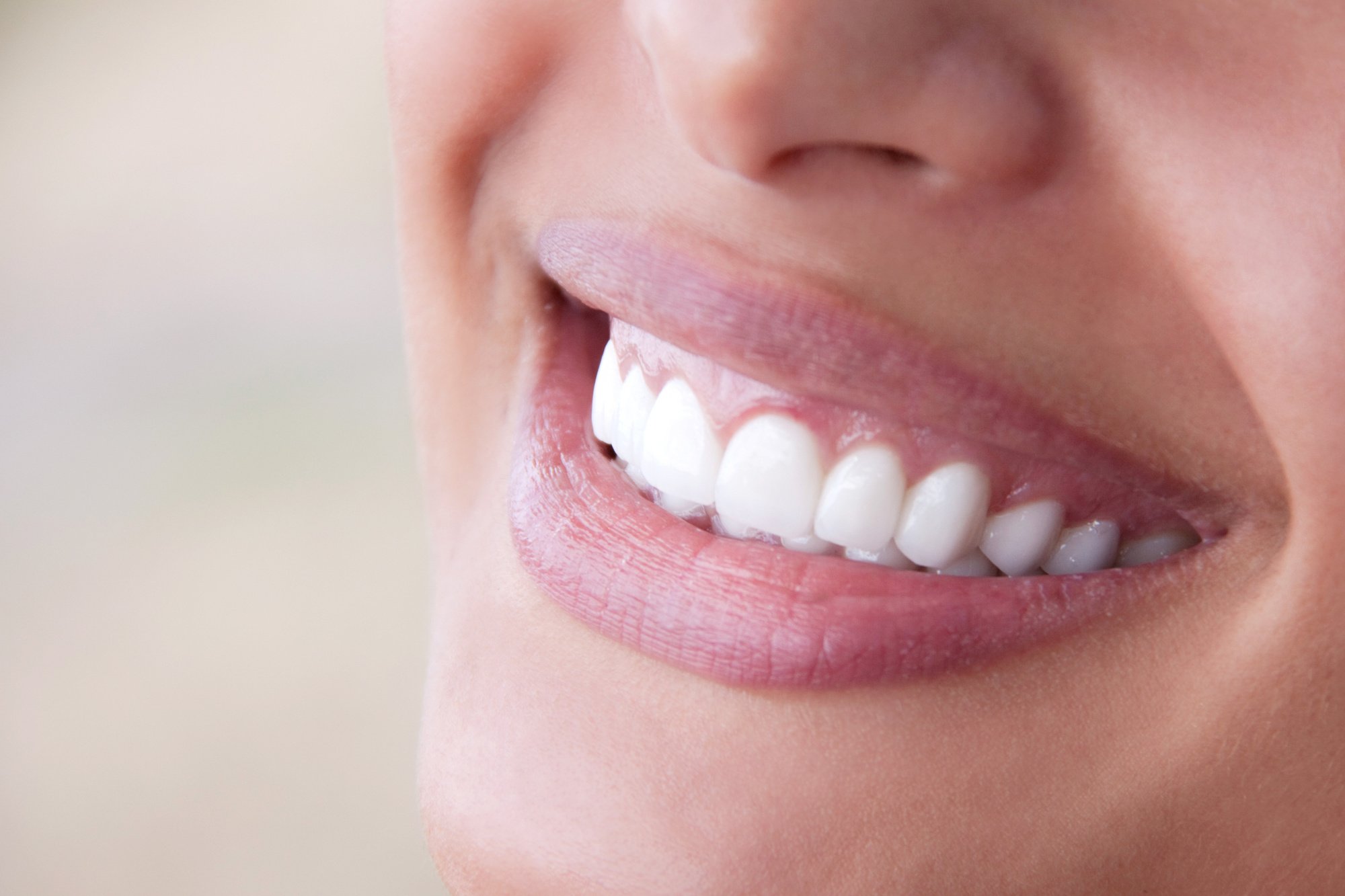Are you planning on getting dental veneers in the near future? Learn all about the dental veneer process in this blog and prepare yourself accordingly.
